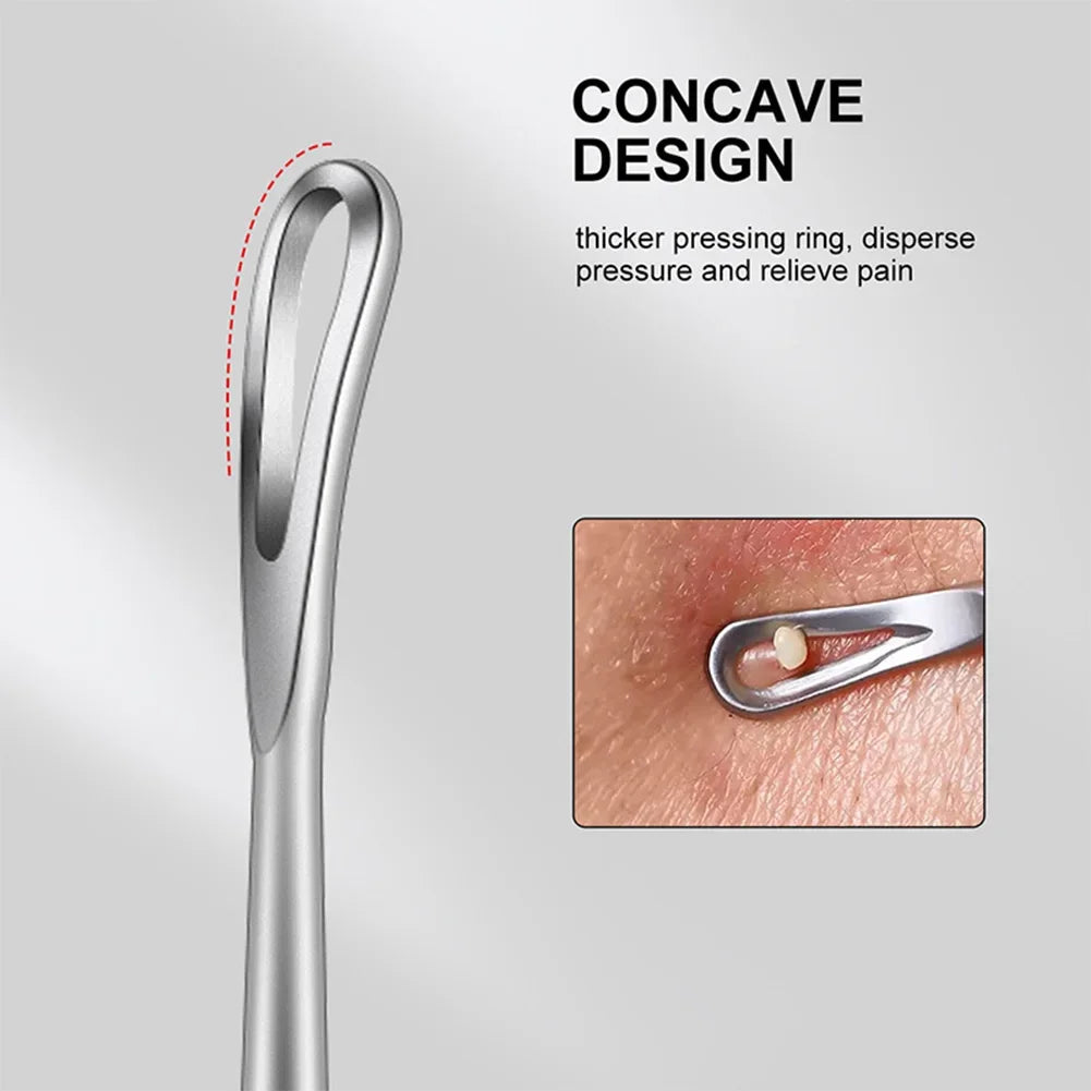 Double head stainless steel blackhead remover tool by amzzonstore with black and silver design for blemish and pimple extraction.