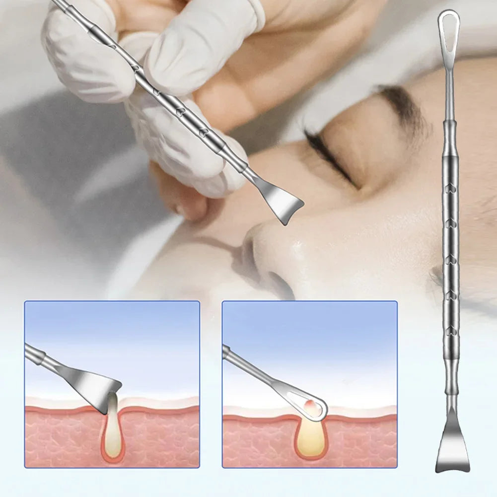 Double head stainless steel blackhead remover tool from amzzonstore, designed for face blemish and pimple extraction.