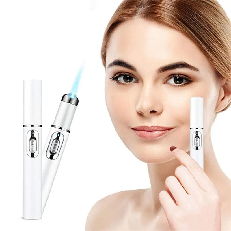 Electric eye massager wand by amzzon.store with blue light therapy, designed for anti-aging, dark circles, and eye bag reduction.