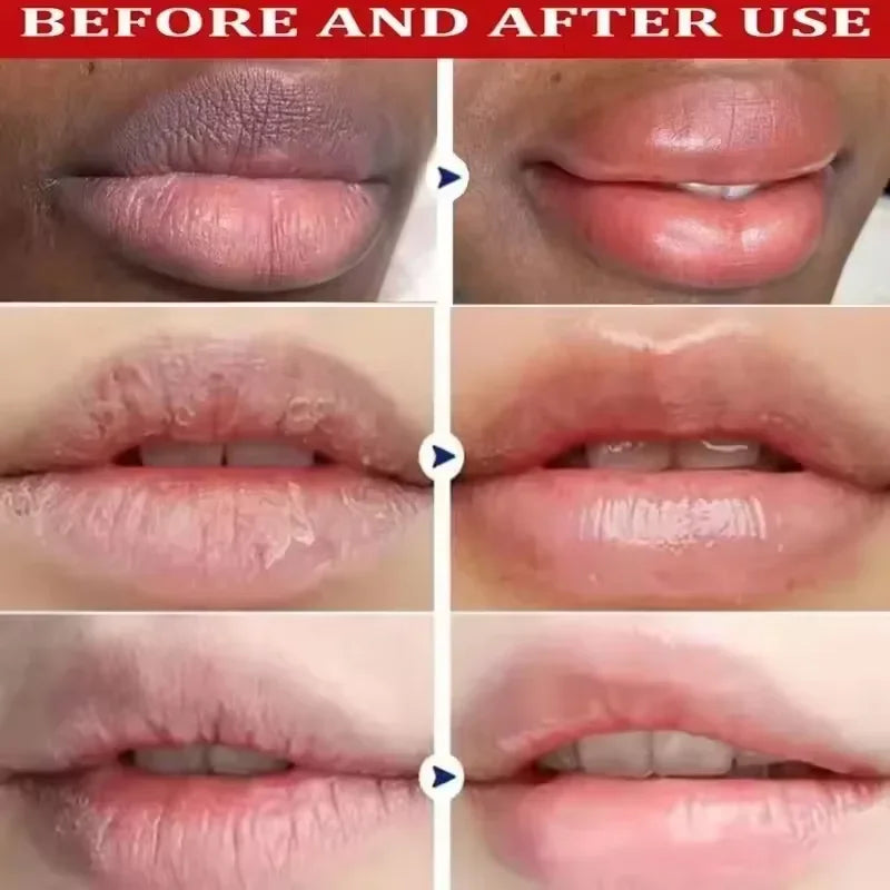 Amzzonstore melanin lip mask with serum for dark lips, exfoliating, nourishing, and repairing dry, dead skin on lips.