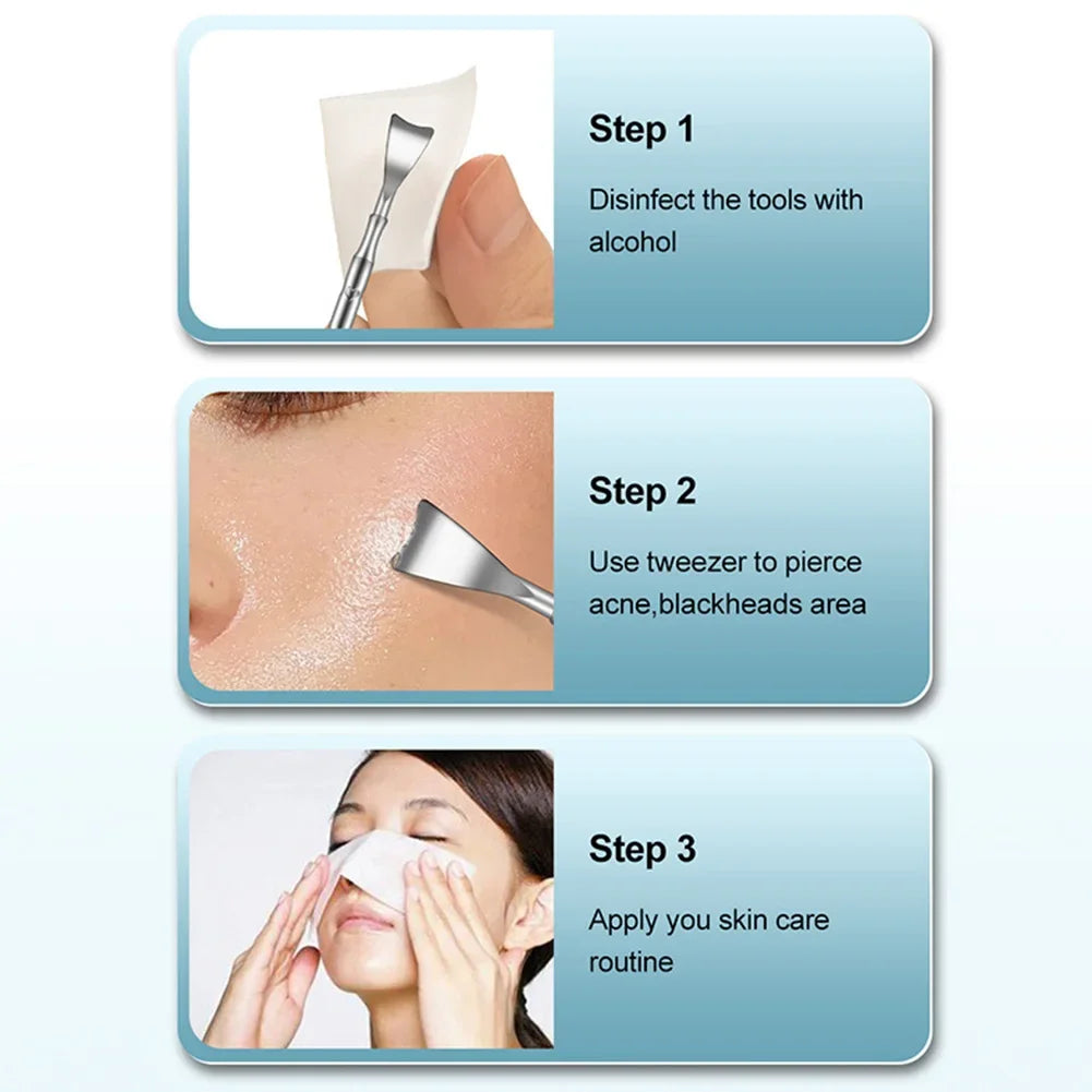 Double head stainless steel blackhead remover tool by amzzonstore with professional design for facial blemish and pimple extraction.