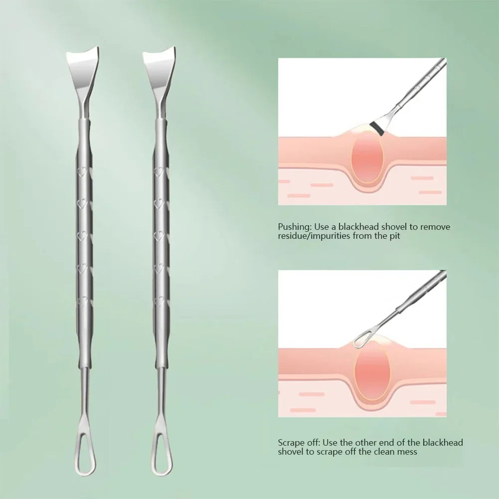 Double head stainless steel blackhead remover tool with black and silver finishes for face blemish and pimple extraction.