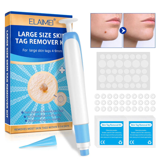 Amzzonstore large skin tag removal kit with cleansing swabs, designed for 4-9mm skin tags for home use on face and body.